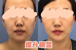 -繁星轻医美连锁