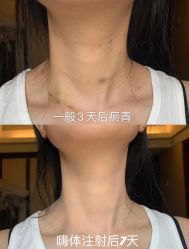 -上海漾颜医疗美容