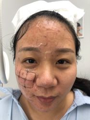 -小忠丽格医美