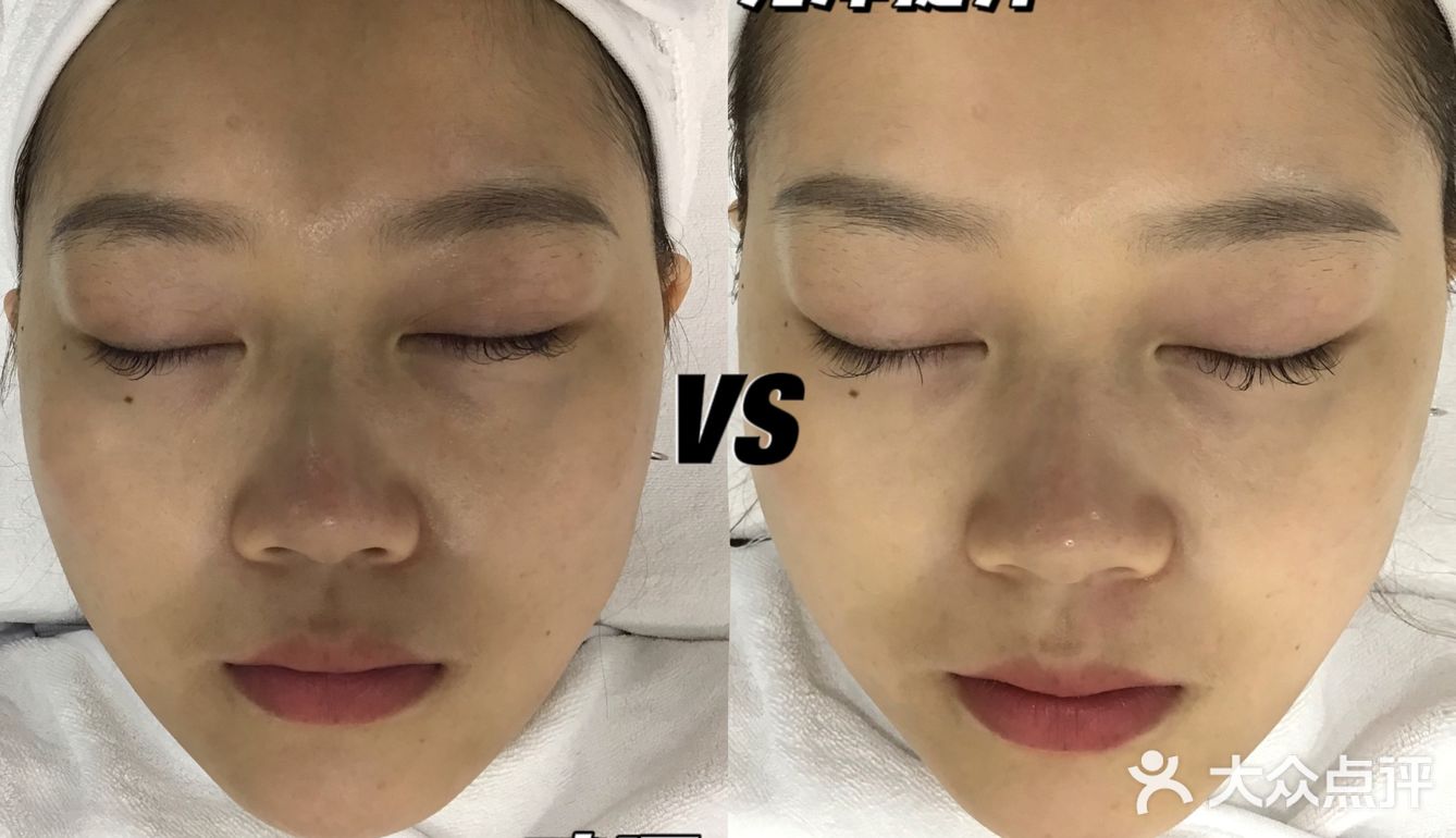 脸上贴24K黄金是什么体验‼️‼️‼️