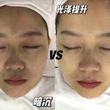 脸上贴24K黄金是什么体验‼️‼️‼️