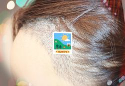 -大麦微针植发全国连锁