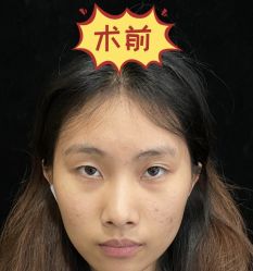 -素美医疗美容·西南眼鼻整形·修复基地