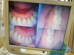 -赫尔森口腔·牙齿种植修复