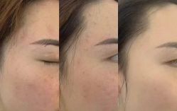 -星港国际·Skin皮肤专研·皮肤管理