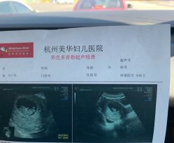 -杭州贝瑞斯美华妇儿医院·早孕·产检·儿科