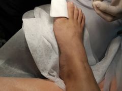 -世龙世家灰指甲鸡眼脚气甲沟炎跖疣护理(通州店)