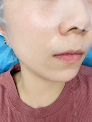 -小忠丽格医美