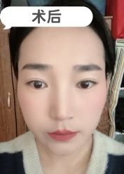-素美医疗美容·西南眼鼻整形·修复基地