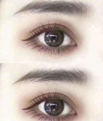 -东莞缔美美容医院