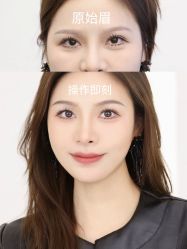 点击看大图 -杨益美学·野生眉半永久纹眉发际线