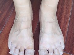 -Andrew指甲专科灰指甲·甲沟炎矫正·3D步态矫形鞋垫定制(上海法华镇路旗舰店)