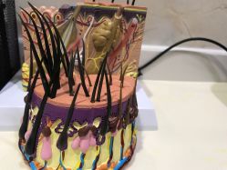 点击看大图 -雍禾植发全国连锁