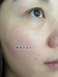 体验前-上海星和医疗美容