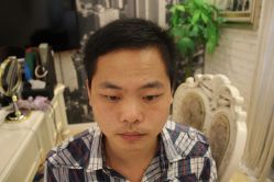 点击看大图 -大麦微针植发丨全国连锁