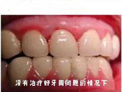 -团圆口腔·种植中心(锦江院区)