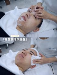 -悟空祛痘·诺奖技术专业店