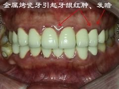 -团圆口腔·种植中心(锦江院区)