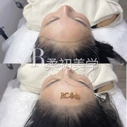 -RC半永久纹眉纹发际线