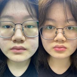 -郡艺医疗美容·微整·眼鼻吸脂
