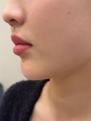-长沙雅美医疗美容医院