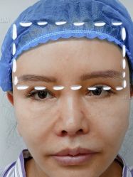 -华美整形美容医院