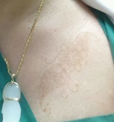 android_upload_pic-Black Tattoo Studio