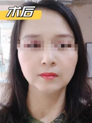 -素美医疗美容·西南眼鼻整形·修复基地