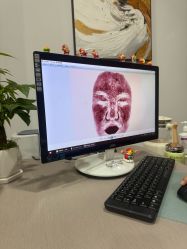 点击看大图 -苏亚医美·高端注射明星整形机构