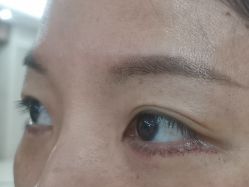 -厦门美莱整形美容医院