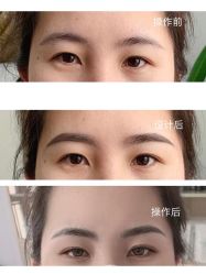 -久匠半永久纹眉