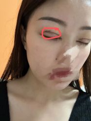 -成都西区医院整形美容