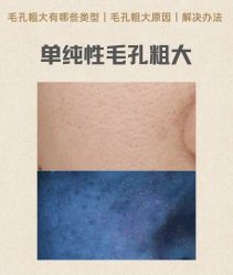 -玛莲朵·海菲秀冰珀科