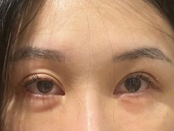 体验前-天河爱来医疗美容门诊部