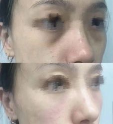 -Yestar重庆艺星医疗美容医院