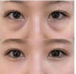 -紫洁俪方（北京）医疗美容