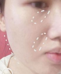 -佛山艺美医疗美容·整形·美肤·塑形