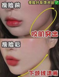 -上海漾颜医疗美容