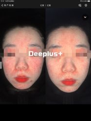 -Deeplus+韩国皮肤管理한국피부관리·C:Lab肌肤实验室