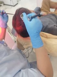 -大麦微针植发丨全国连锁