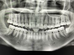 -众鑫医疗小白牙口腔(土桥店)