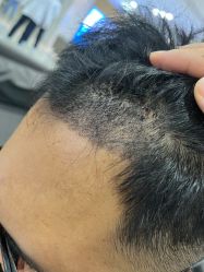 -雍禾植发全国连锁