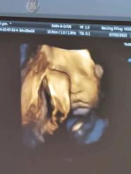 -北京俪婴妇产医院(朝阳大悦城店)