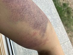 -养心阁足道馆(火宫殿一店)