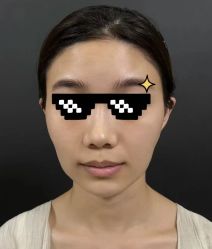 -天津健丽·去眼袋医疗美容机构