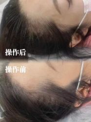 -西施无菌半永久纹绣眉眼影唇轻增发纹发际线