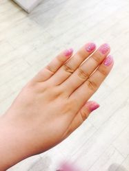 -薇兰专业脱毛连锁机构