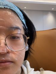 体验后-深圳米兰柏羽医疗美容医院