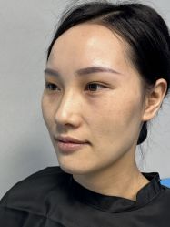 体验前-贵阳美莱医疗美容整形医院
