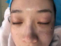 点击看大图 -SKINIST丽铂医疗美容
